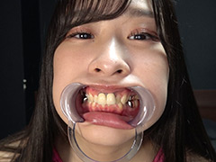adoa-1778【くすぐりエロ動画】朝比ゆのチャンの歯&口腔&のどちんこ観察と小魚舐め!